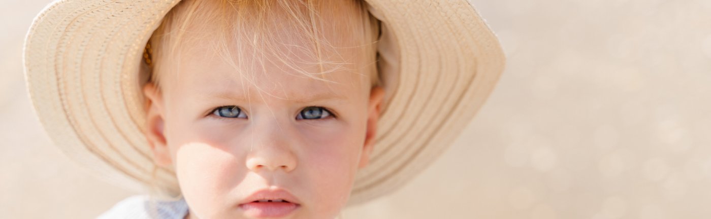 Sunčanica kod dece
